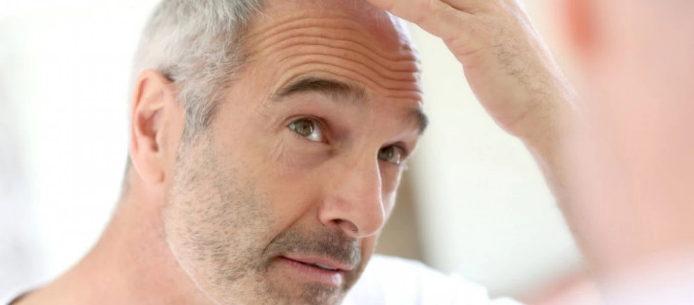 Ερευνητές βρήκαν τον λόγο που τα μαλλιά μπορεί να ασπρίσουν σε μια νύχτα